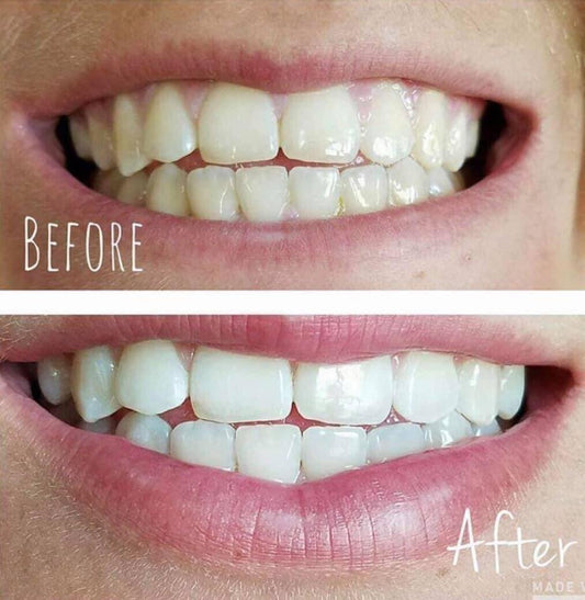 Whitening Toothpaste